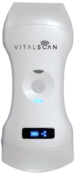 Ecografo connesso ultraportatile Vital Scan X5