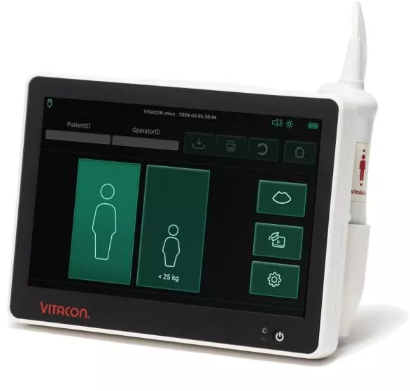 Scanner vescicale / Scanner vescicale portatile eVue VitaScan