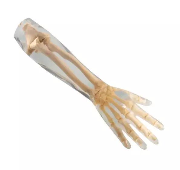 Fantasma radiografico dell'avambraccio Erler Zimmer