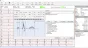ECG digitale Spengler Cardiomate PC-ECG (12 canali)