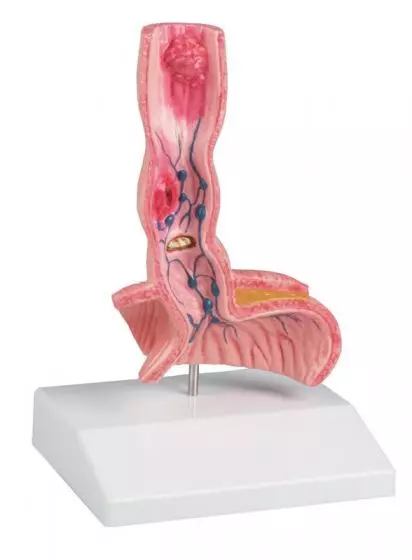 Modello dell'esofago umano con patologie Erler Zimmer K218