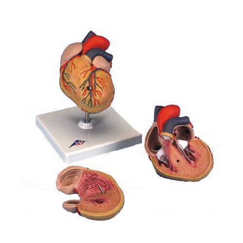 Modello classico di cuore con ipertrofia ventricolare sinistra, in 2 parti G04