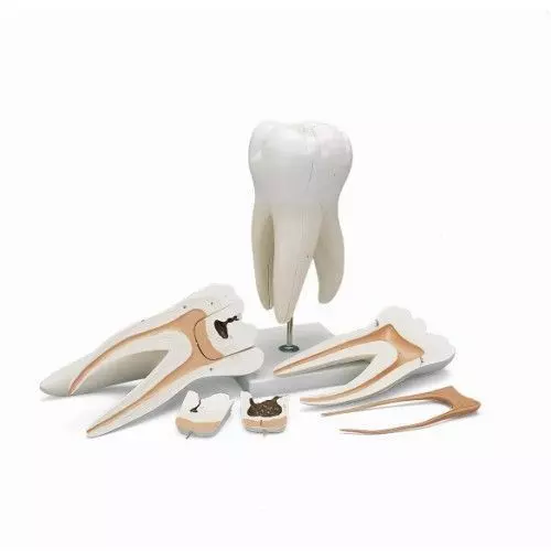 Dente molare superiore a tre radici, in 6 parti D15