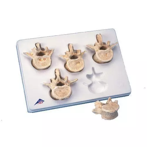 Set con 5 vertebre lombari A792