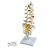 Modello di Colonna vertebrale lombare con ernia del disco dorsolaterale A76/5