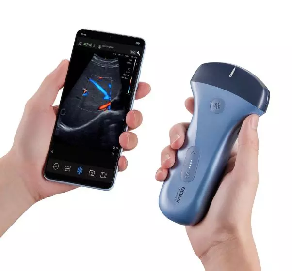 Ecografo ultraportatile connesso Edan Nano per smartphone e tablet (colore)