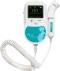 Doppler fetale e vascolare tascabile Sonoline C (con sonda a 2, 3 o 8 Mhz)