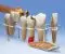 Modello di protesi dentaria, ingrandito 10 volte, in 7 parti - Tedesco W42528