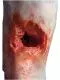 Modello di gamba con ferita da granata Erler Zimmer R50020
