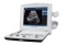Ecografo portatile Edan DUS60