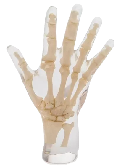 Fantasma radiografico della mano Erler Zimmer