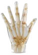 Fantasma radiografico della mano Erler Zimmer