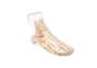 Fantasma radiografico del piede Erler Zimmer