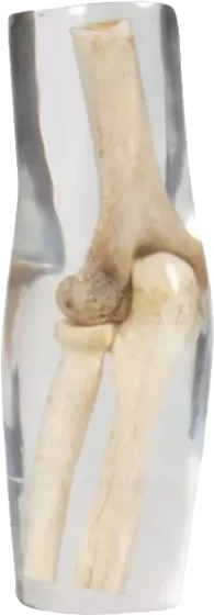 Fantasma del gomito a raggi X di Erler Zimmer