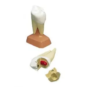 Dente molare superiore con due radici, in 2 parti VE299