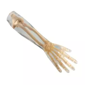 Fantasma radiografico dell'avambraccio Erler Zimmer