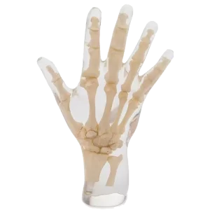 Fantasma radiografico della mano Erler Zimmer