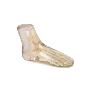 Fantasma radiografico del piede Erler Zimmer