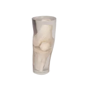 Fantasma radiografico per ginocchio Erler Zimmer