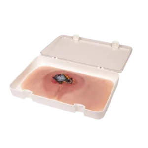 Modello di ferita da decubito sacrale non trattata di Erler Zimmer