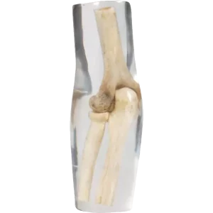 Fantasma del gomito a raggi X di Erler Zimmer