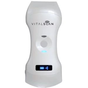 Ecografo connesso ultraportatile Vital Scan X5