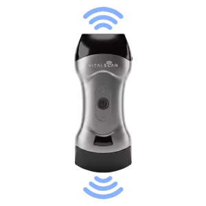 Ecografo connesso ultraportatile Vital Scan X5