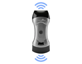 Ecografo connesso ultraportatile Vital Scan X5