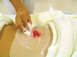 Simulatore I di stoma per il tirocinio con custodia W60909