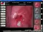 Software per colposcopia per Colpro, Colpy