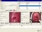Software per colposcopia per Colpro, Colpy