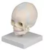 Modello cranio fetale 30 settimane 4519 Erler Zimmer