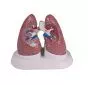 Modello anatomico didattico di polmoni con malattie G52 Erler Zimmer