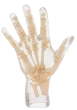 Fantasma radiografico della mano Erler Zimmer