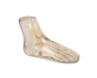 Fantasma radiografico del piede Erler Zimmer