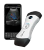 Ecografo ultraportatile connesso Bionet SonoMe